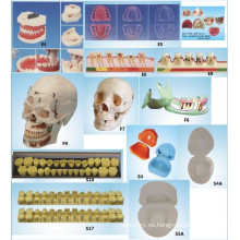 Equipo de Educación Científica Oral Modelo de Enfermedad Periodontal Modelo Dental